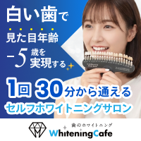 ポイントが一番高いホワイトニングカフェ（ホワイトニング専門店）